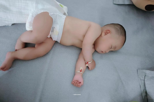 九江宝宝褶皱处擦粉还是油